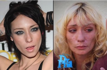 美超模因吸毒毁容 盘点明星吸毒前后恐怖对比照