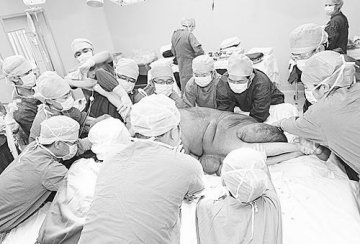 解放军301医院成功切除巨大神经纤维瘤