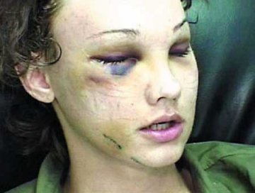 整容真人秀节目血腥暴露 被网友斥为三级片