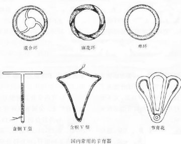 女性上避孕环全过程