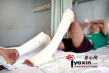 乌鲁木齐神秘火坑灼伤三人 坑内系何物成谜