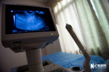 其中一间取卵室的仪器上还套着安全套
