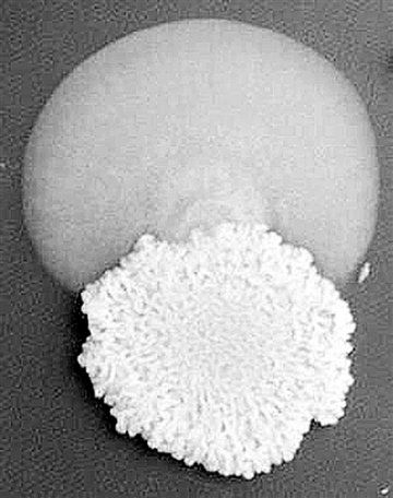 认识微生物再上新台阶--科学家在微生物耐药性中发现新机制