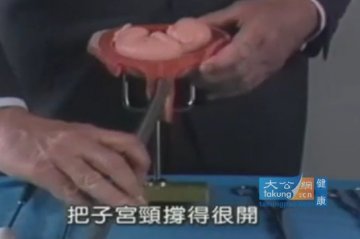 实拍堕胎手术全过程 呼吁珍惜生命