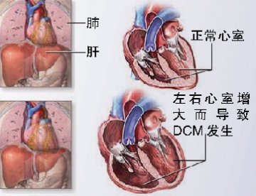 心影增大，要考虑DCM