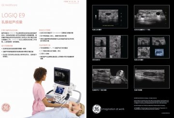 超声诊断仪 Diagnostic Ultrasound Scanner LOGIQ E9--官方高清创意广告(沪医械广审