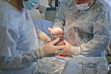 高清：直击年轻母亲剖腹产分娩全过程