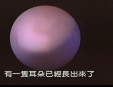 实拍：美国堕胎手术全过程