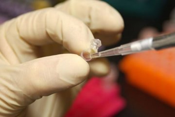 英国NHS宣布启动“100000基因组计划” 皆在治疗癌症和罕见疾病