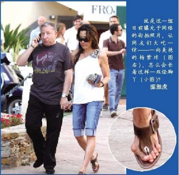 杨紫琼拇外翻很严重