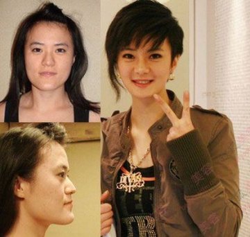 31个惊人韩国整容案例