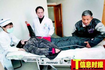 全球最恐怖的67种怪病