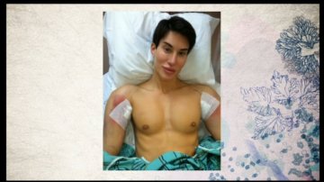 男子整容似真人版肯尼