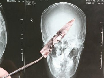 世界最离奇X光大曝光