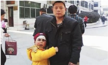 7岁男孩患白血病 药物原因致面部严重变形