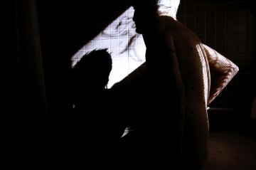 美摄影师自拍硬化症患者真实生活
