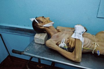 传染病死亡率排行榜中，肺结核排名第二