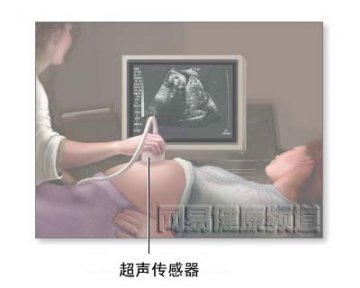 超声检查法