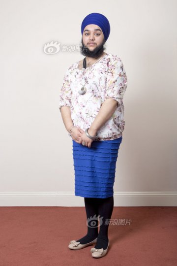 英国23岁女子长满脸络腮胡 称很性感
