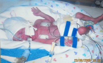 英少女阵痛20天终成功生产 堪称“史上最牛孕妇”