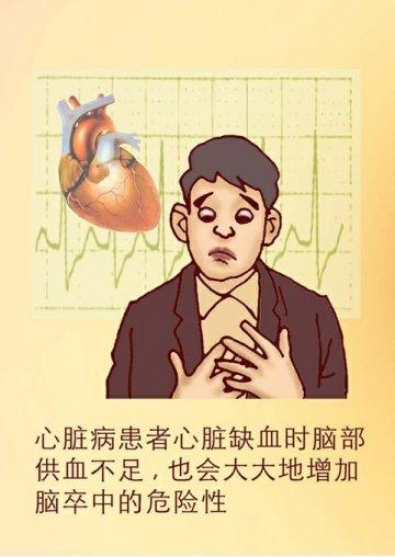 中风8大高危人群