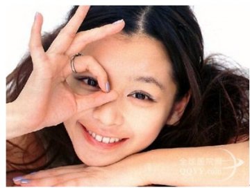 南充做准分子激光治疗近视越来越趋向“个性化”