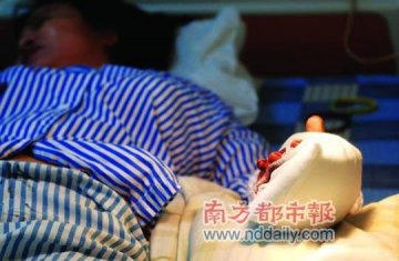 劫匪因抢不到2元钱假戒指咬伤女子中指