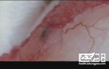 神奇的生命：实拍女性排卵真实过程