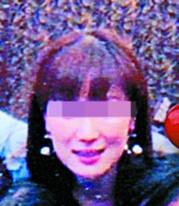 女子整形遭毁容眼睛肿如灯泡 医院称手术没问题
