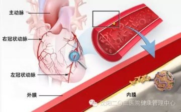 高胆固醇血症与冠心病只一步之遥