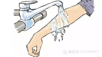 军医详解烧伤后如何进行康复治疗