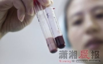 男子抽出乳白色血液 称喜欢用油汤拌饭吃