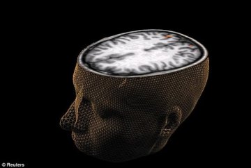 科学家大脑扫描实验证实能看到人们所想事物 有望对孤独症等患者进行新的治疗