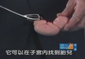 实拍堕胎手术全过程 呼吁珍惜生命