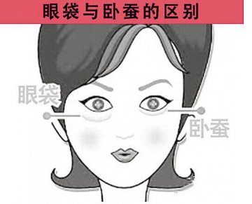 卧蚕和眼袋是两回事 专家教你如何区分