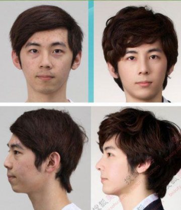 31个惊人韩国整容案例