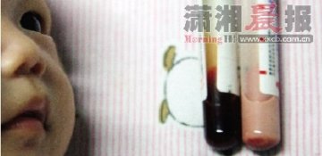新生婴儿患上怪病血液由红变乳白