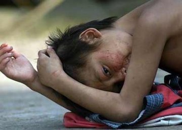 14岁少年患怪病残杀生吞鸡鸭