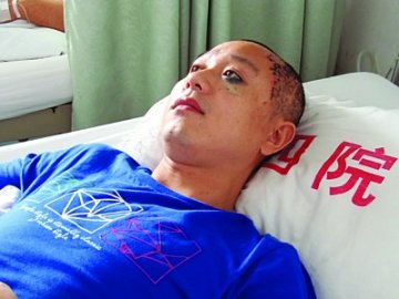男子眼周黑色素瘤扩散入脑 3次开颅医生称似割韭菜