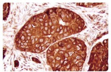 朱莉切卵巢不值效仿 专家：术后会出现严重更年期症状