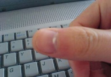 指甲下面有块白点