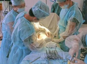 实拍剖腹产震撼生产过程