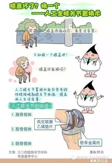 图解：人工全膝关节置换术