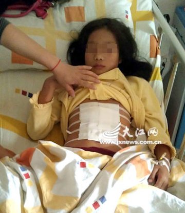 11岁女童与同学爬旗杆比赛险遭剖腹