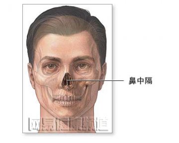 鼻中隔成形术