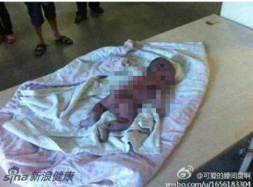 网曝福建泉州疑被医院保温箱烫死婴儿事件