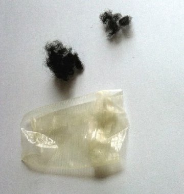 南京现“避孕套皮筋” 专家：使用不当可能染病