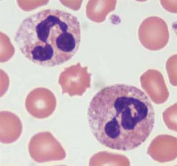 中性粒细胞（Neutrophil）
