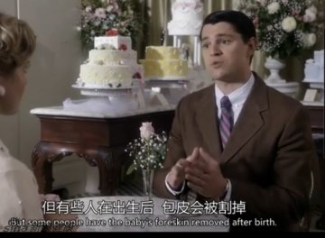 出生后就做包皮手术吗