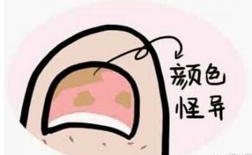 专家：“一个月内治愈灰指甲”广告不可信